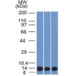 Western Blot - Anti-S100A4 Antibody [S100A4/1481] (A249920) - Antibodies.com