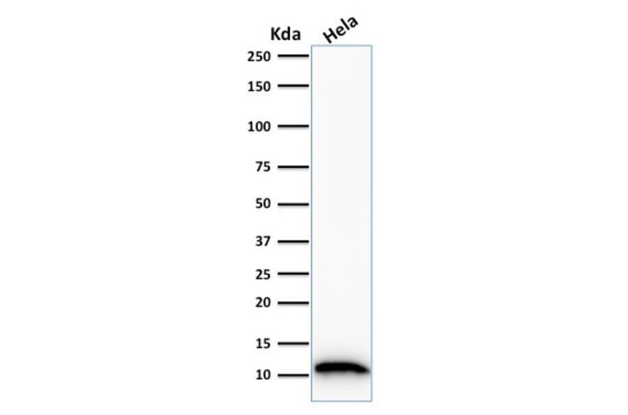 Western Blot - Anti-S100A4 Antibody [S100A4/1481] (A249920) - Antibodies.com