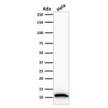 Western Blot - Anti-S100A4 Antibody [S100A4/1481] (A249920) - Antibodies.com
