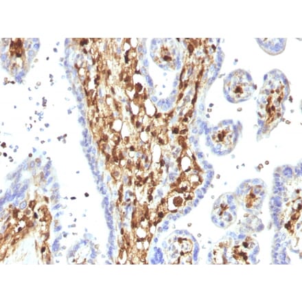 Immunohistochemistry - Anti-S100A4 Antibody [S100A4/1482] (A249921) - Antibodies.com