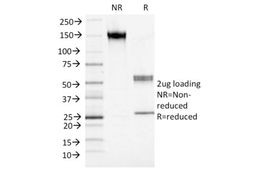 SDS-PAGE - Anti-S100A4 Antibody [S100A4/1482] (A249921) - Antibodies.com