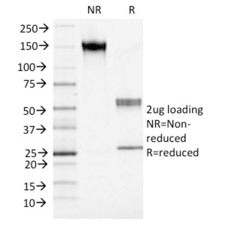 SDS-PAGE - Anti-S100A4 Antibody [S100A4/1482] (A249921) - Antibodies.com