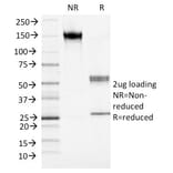 SDS-PAGE - Anti-S100A4 Antibody [S100A4/1482] (A249921) - Antibodies.com