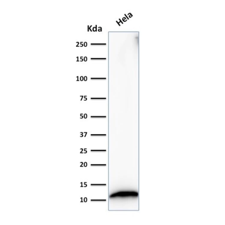 Western Blot - Anti-S100A4 Antibody [S100A4/1482] (A249921) - Antibodies.com