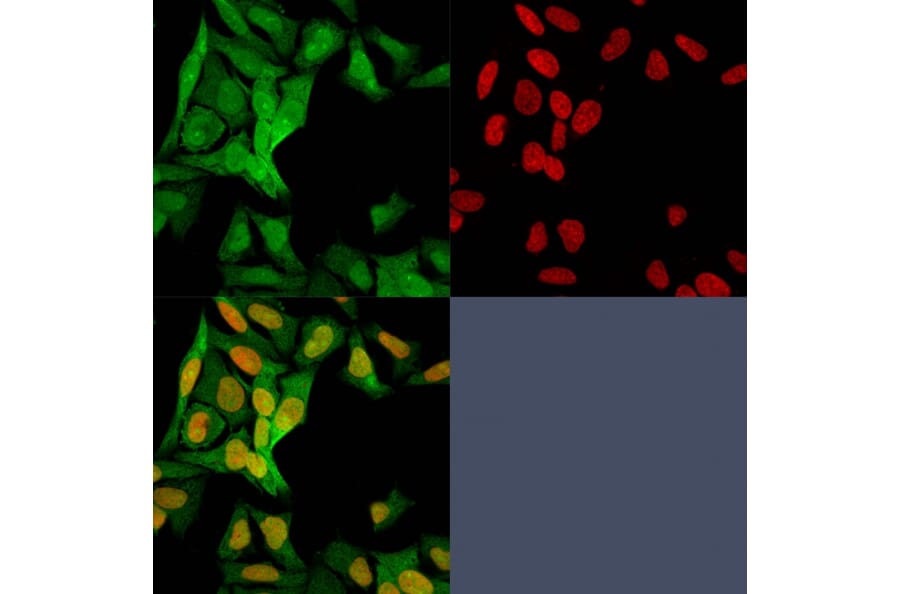 Immunofluorescence - Anti-S100A4 Antibody [S100A4/1482] (A249921) - Antibodies.com