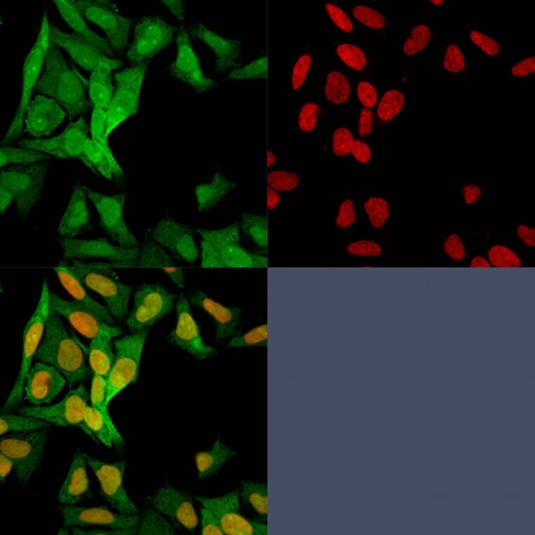 Immunofluorescence - Anti-S100A4 Antibody [S100A4/1482] (A249921) - Antibodies.com