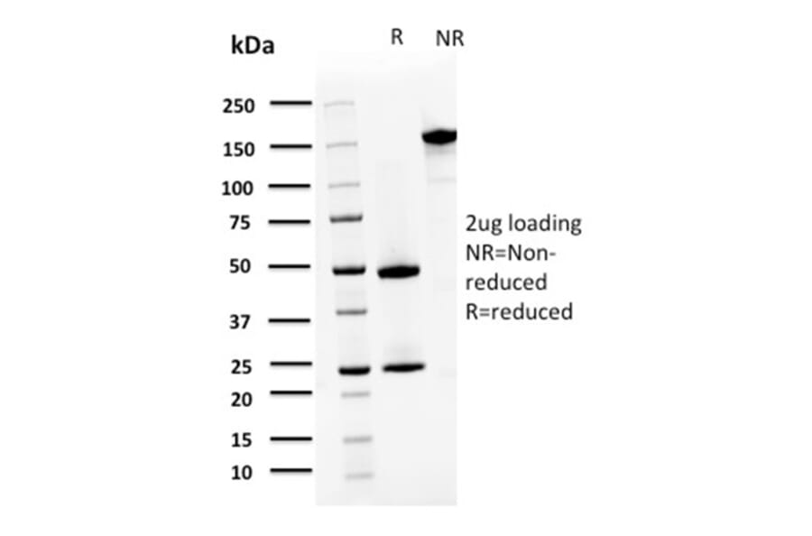 SDS-PAGE - Anti-S100A4 Antibody [CPTC-S100A4-3] (A249922) - Antibodies.com
