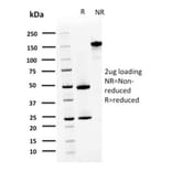 SDS-PAGE - Anti-S100A4 Antibody [CPTC-S100A4-3] (A249922) - Antibodies.com