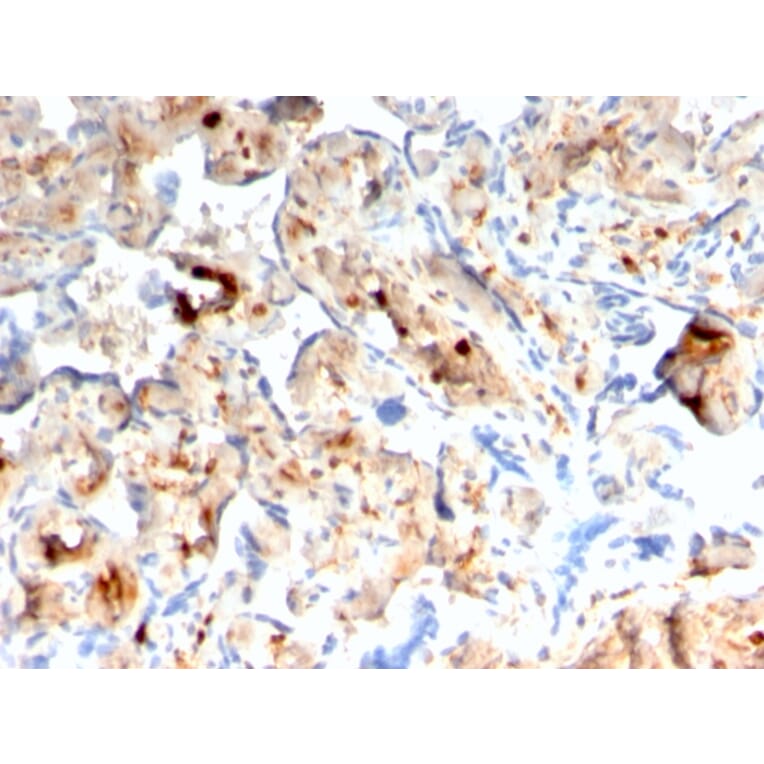 Immunohistochemistry - Anti-S100A4 Antibody [rS100A4/1481] (A249923) - Antibodies.com