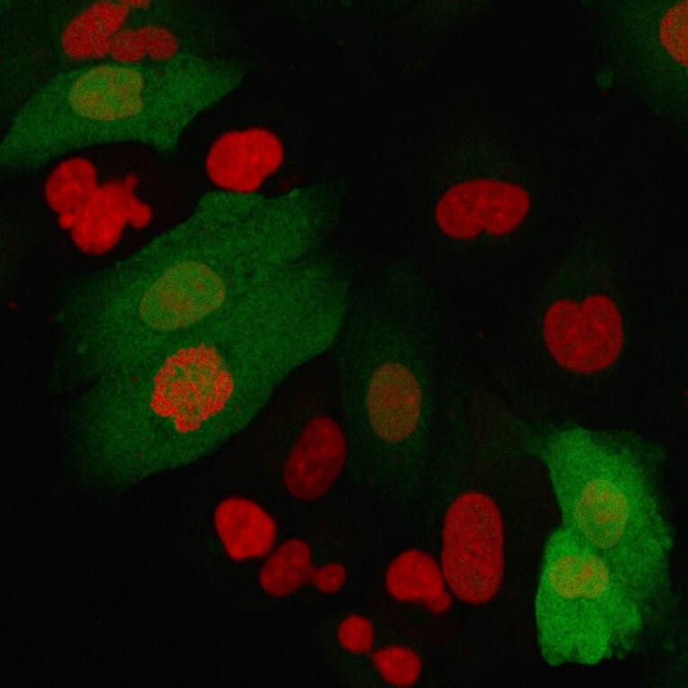 Immunofluorescence - Anti-S100A4 Antibody [rS100A4/1481] (A249923) - Antibodies.com