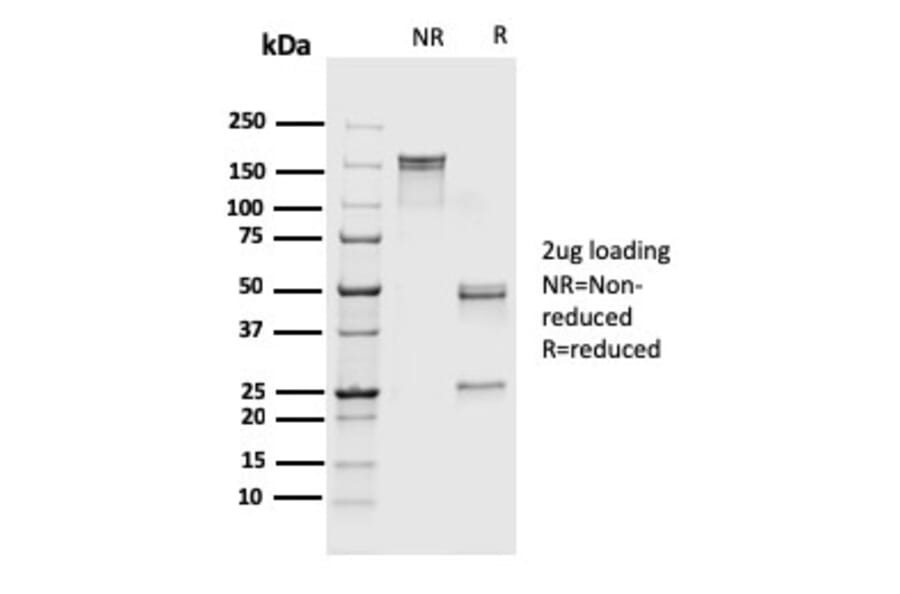 SDS-PAGE - Anti-S100A4 Antibody [rS100A4/1481] (A249923) - Antibodies.com