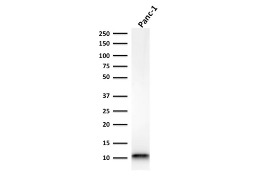 Western Blot - Anti-S100A4 Antibody [rS100A4/1481] (A249923) - Antibodies.com
