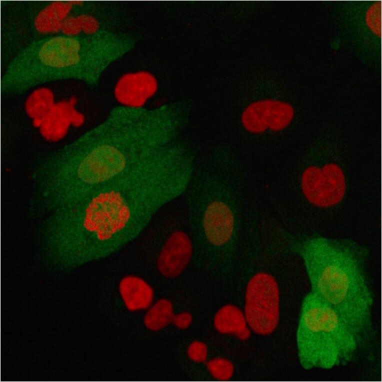 Immunofluorescence - Anti-S100A4 Antibody [S100A4/2750R] (A249924) - Antibodies.com