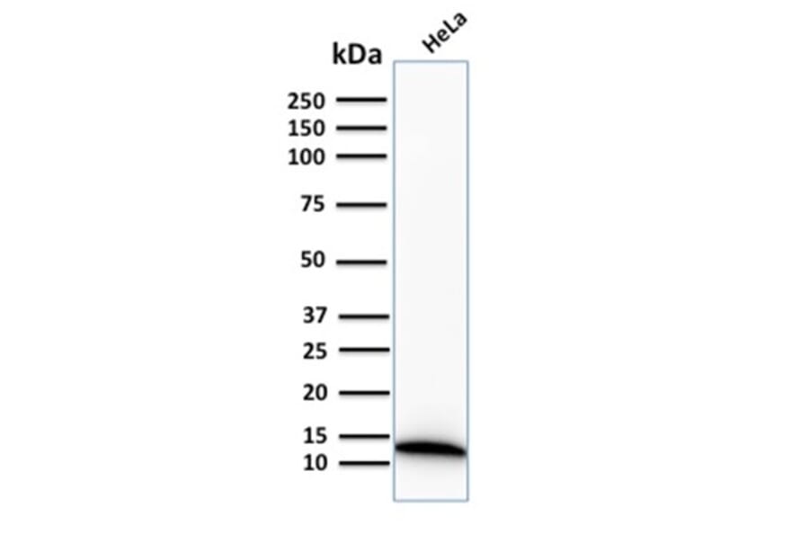 Western Blot - Anti-S100A4 Antibody [S100A4/2750R] (A249924) - Antibodies.com