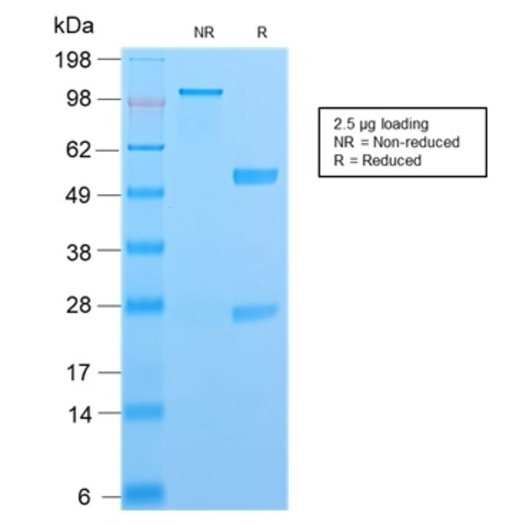SDS-PAGE - Anti-S100A4 Antibody [S100A4/2750R] (A249924) - Antibodies.com
