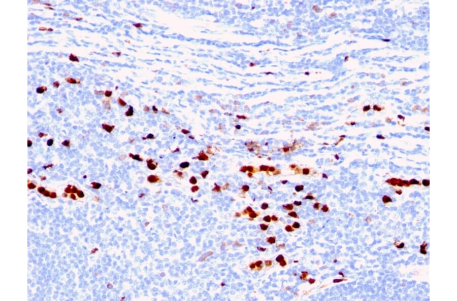 Immunohistochemistry - Anti-Calprotectin Antibody [MAC387] (A249924) - Antibodies.com