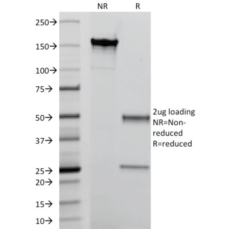 SDS-PAGE - Anti-Calprotectin Antibody [MAC387] (A249925) - Antibodies.com