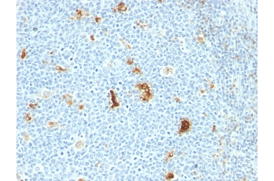 Immunohistochemistry - Anti-Macrophage L1 Protein Antibody [SPM281] (A249925) - Antibodies.com