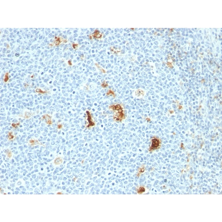 Immunohistochemistry - Anti-Macrophage L1 Protein Antibody [SPM281] (A249925) - Antibodies.com