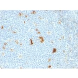 Immunohistochemistry - Anti-Macrophage L1 Protein Antibody [SPM281] (A249925) - Antibodies.com