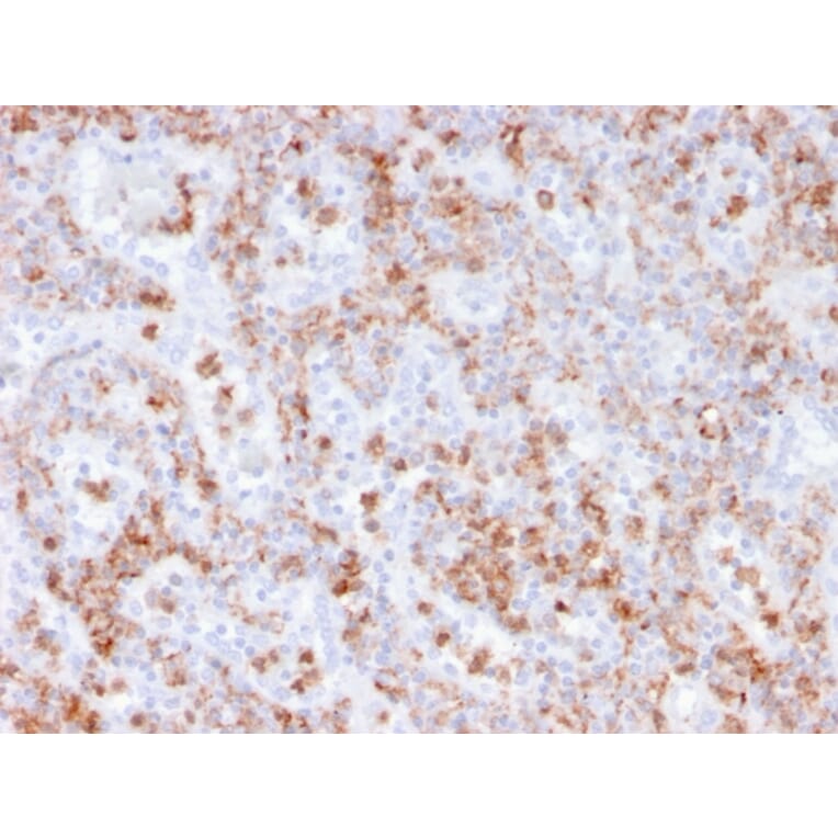Immunohistochemistry - Anti-Calprotectin Antibody [rMAC3781] (A249926) - Antibodies.com