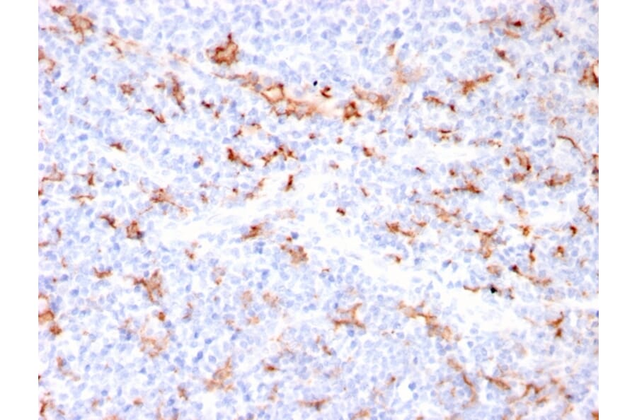 Immunohistochemistry - Anti-S100A9 + Calprotectin Antibody [MAC3157R] (A249928) - Antibodies.com