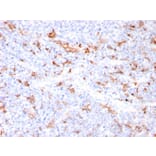 Immunohistochemistry - Anti-S100A9 + Calprotectin Antibody [MAC3157R] (A249928) - Antibodies.com