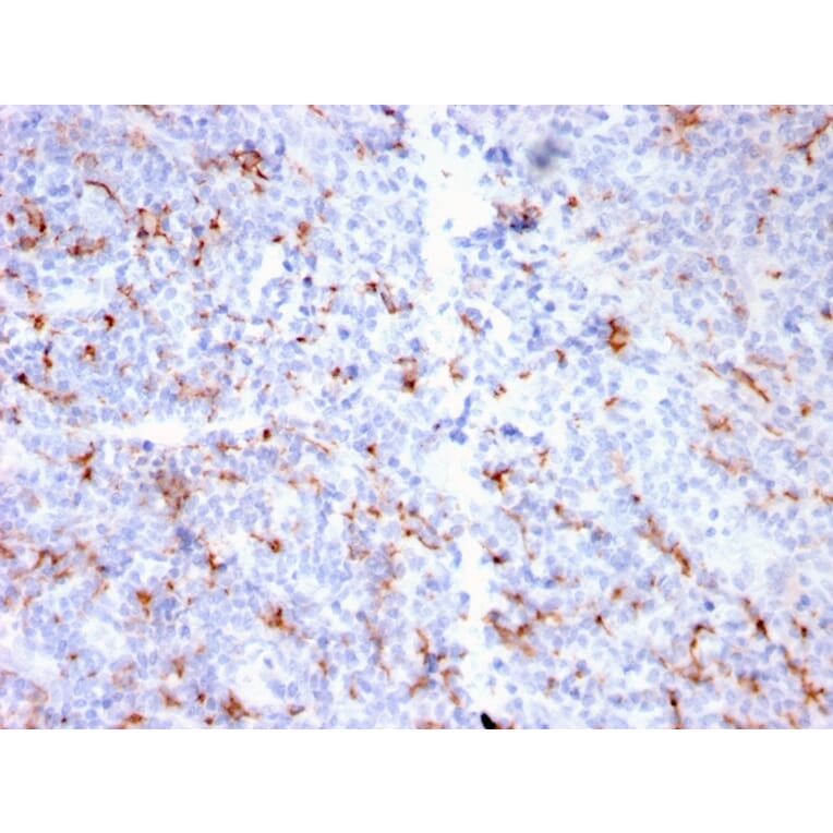 Immunohistochemistry - Anti-S100A9 + Calprotectin Antibody [MAC3157R] (A249927) - Antibodies.com