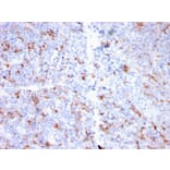 Immunohistochemistry - Anti-S100A9 + Calprotectin Antibody [MAC3157R] (A249927) - Antibodies.com