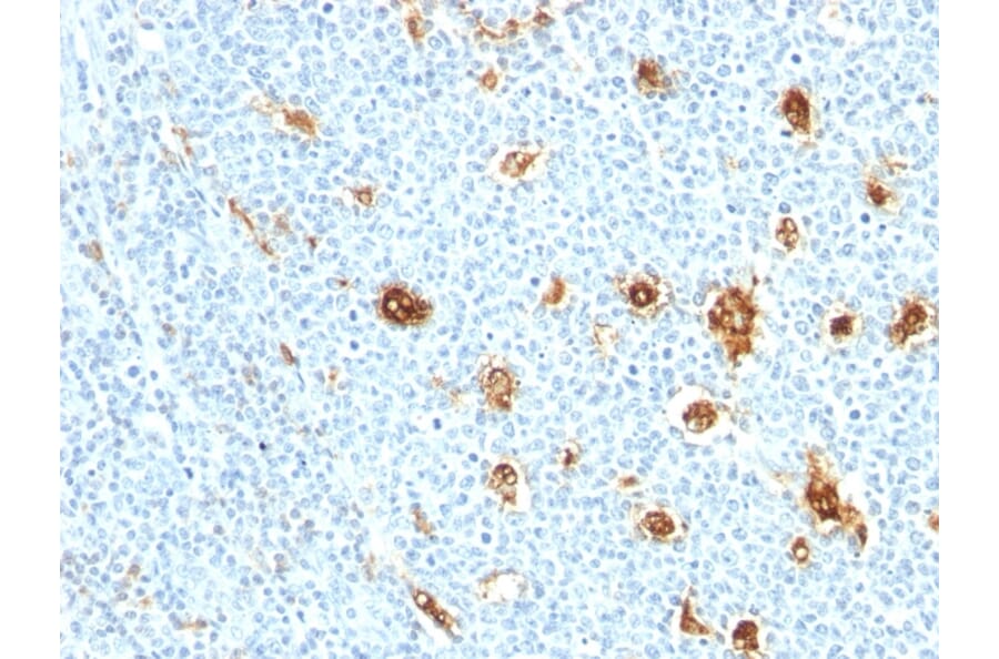 Immunohistochemistry - Anti-Calprotectin Antibody [MRP14/840] (A249928) - Antibodies.com