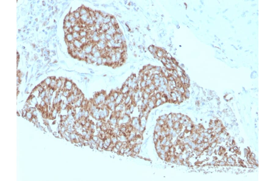 Immunohistochemistry - Anti-Calprotectin Antibody [S100A9/1075] (A249929) - Antibodies.com
