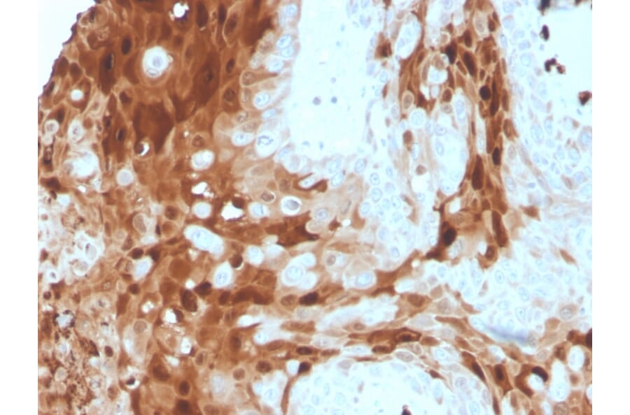 Immunohistochemistry - Anti-Calprotectin Antibody [S100A9/1075] (A249930) - Antibodies.com