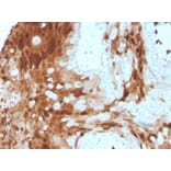 Immunohistochemistry - Anti-Calprotectin Antibody [S100A9/1075] (A249930) - Antibodies.com