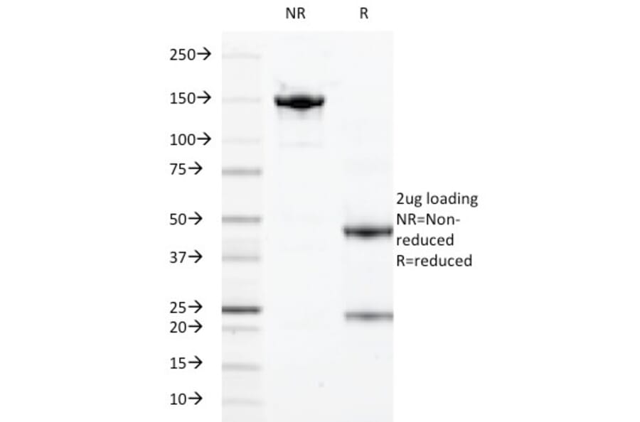 SDS-PAGE - Anti-Calprotectin Antibody [47-8D3] (A251421) - Antibodies.com