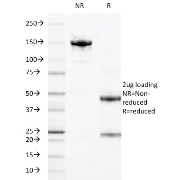 SDS-PAGE - Anti-Calprotectin Antibody [47-8D3] (A251421) - Antibodies.com