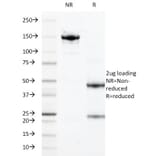 SDS-PAGE - Anti-Calprotectin Antibody [47-8D3] (A251421) - Antibodies.com