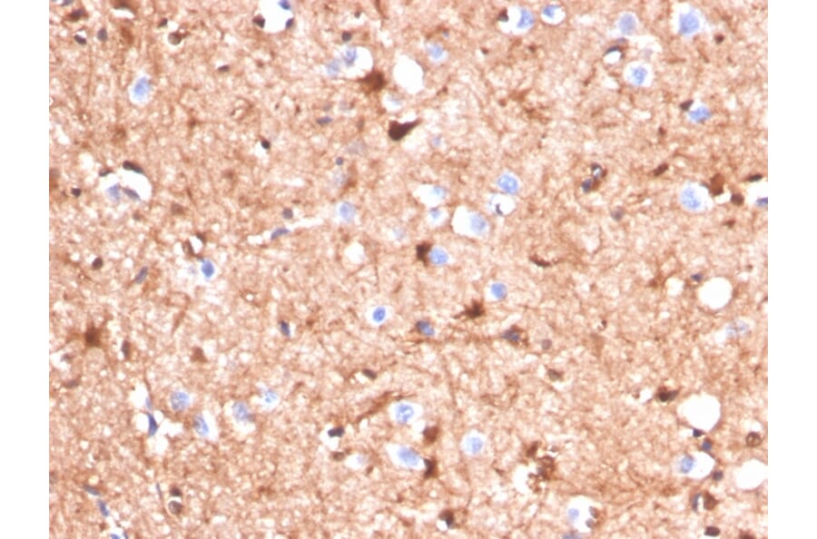 Immunohistochemistry - Anti-S100 beta Antibody [S100B/4140] (A249932) - Antibodies.com