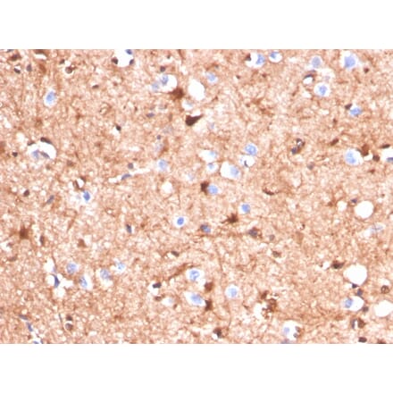Immunohistochemistry - Anti-S100 beta Antibody [S100B/4140] (A249932) - Antibodies.com