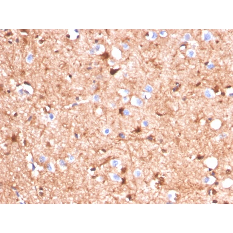 Immunohistochemistry - Anti-S100 beta Antibody [S100B/4140] (A249932) - Antibodies.com