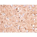 Immunohistochemistry - Anti-S100 beta Antibody [S100B/4140] (A249932) - Antibodies.com