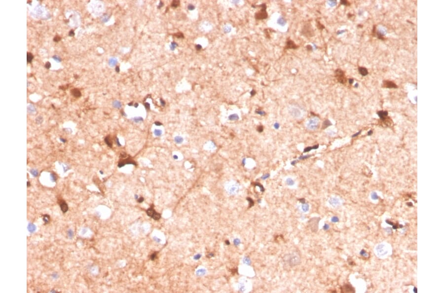 Immunohistochemistry - Anti-S100 beta Antibody [S100B/4141] (A249933) - Antibodies.com