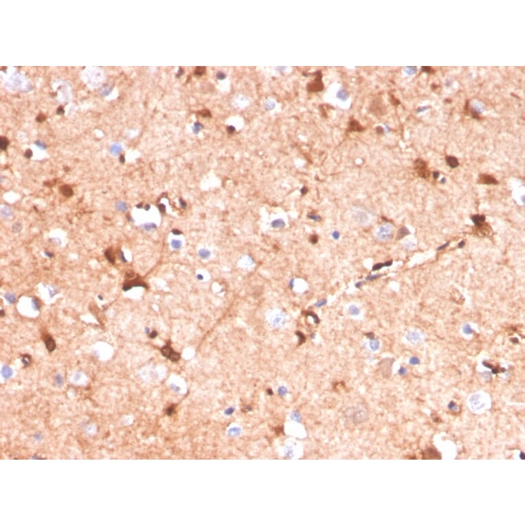 Immunohistochemistry - Anti-S100 beta Antibody [S100B/4141] (A249933) - Antibodies.com