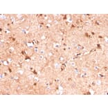 Immunohistochemistry - Anti-S100 beta Antibody [S100B/4141] (A249933) - Antibodies.com