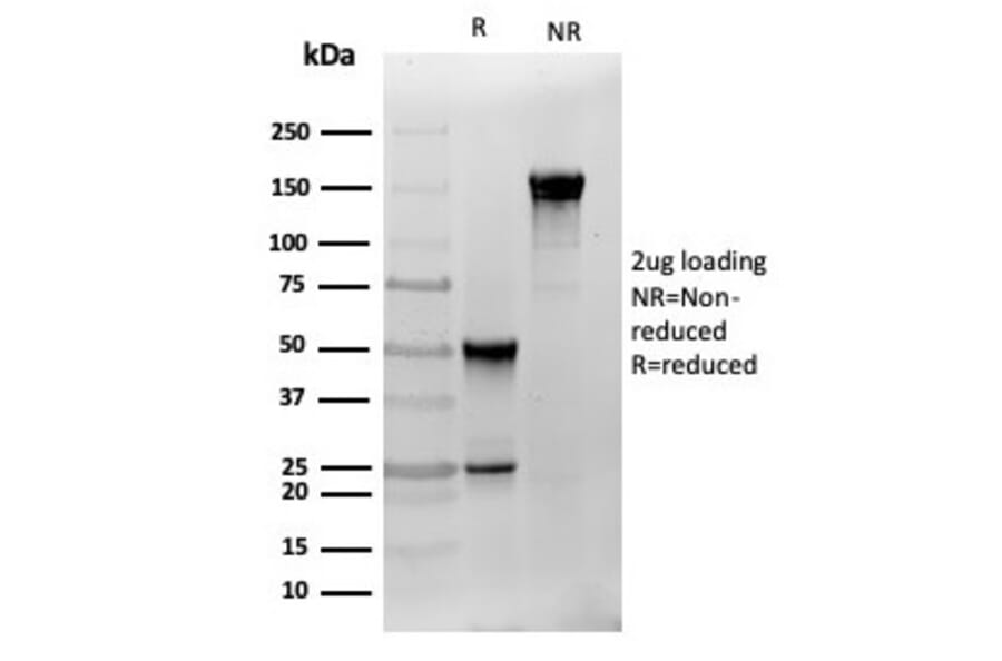 SDS-PAGE - Anti-S100 beta Antibody [S100B/4141] (A249933) - Antibodies.com