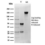 SDS-PAGE - Anti-S100 beta Antibody [S100B/4141] (A249933) - Antibodies.com