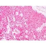 Immunohistochemistry - Anti-S100 beta Antibody [4C4.9] (A249934) - Antibodies.com