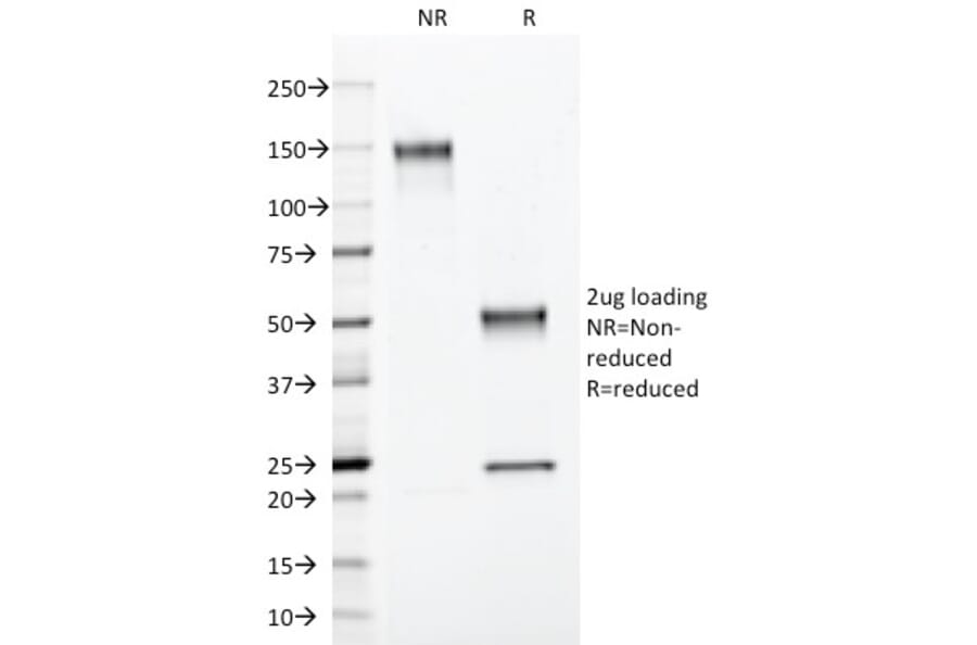 SDS-PAGE - Anti-S100 beta Antibody [4C4.9] (A249934) - Antibodies.com