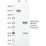 SDS-PAGE - Anti-S100 beta Antibody [4C4.9] (A249934) - Antibodies.com