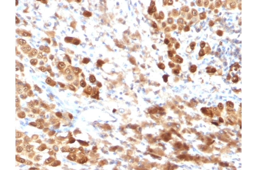 Immunohistochemistry - Anti-S100 beta Antibody [SPM354] (A249934) - Antibodies.com