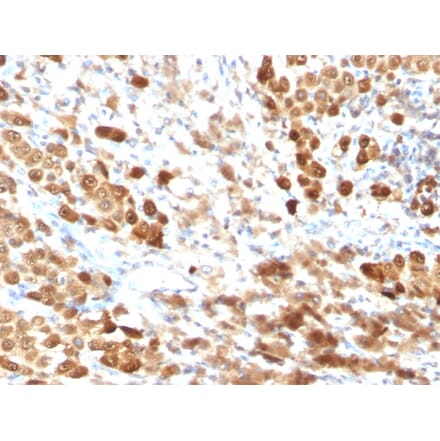 Immunohistochemistry - Anti-S100 beta Antibody [SPM354] (A249934) - Antibodies.com